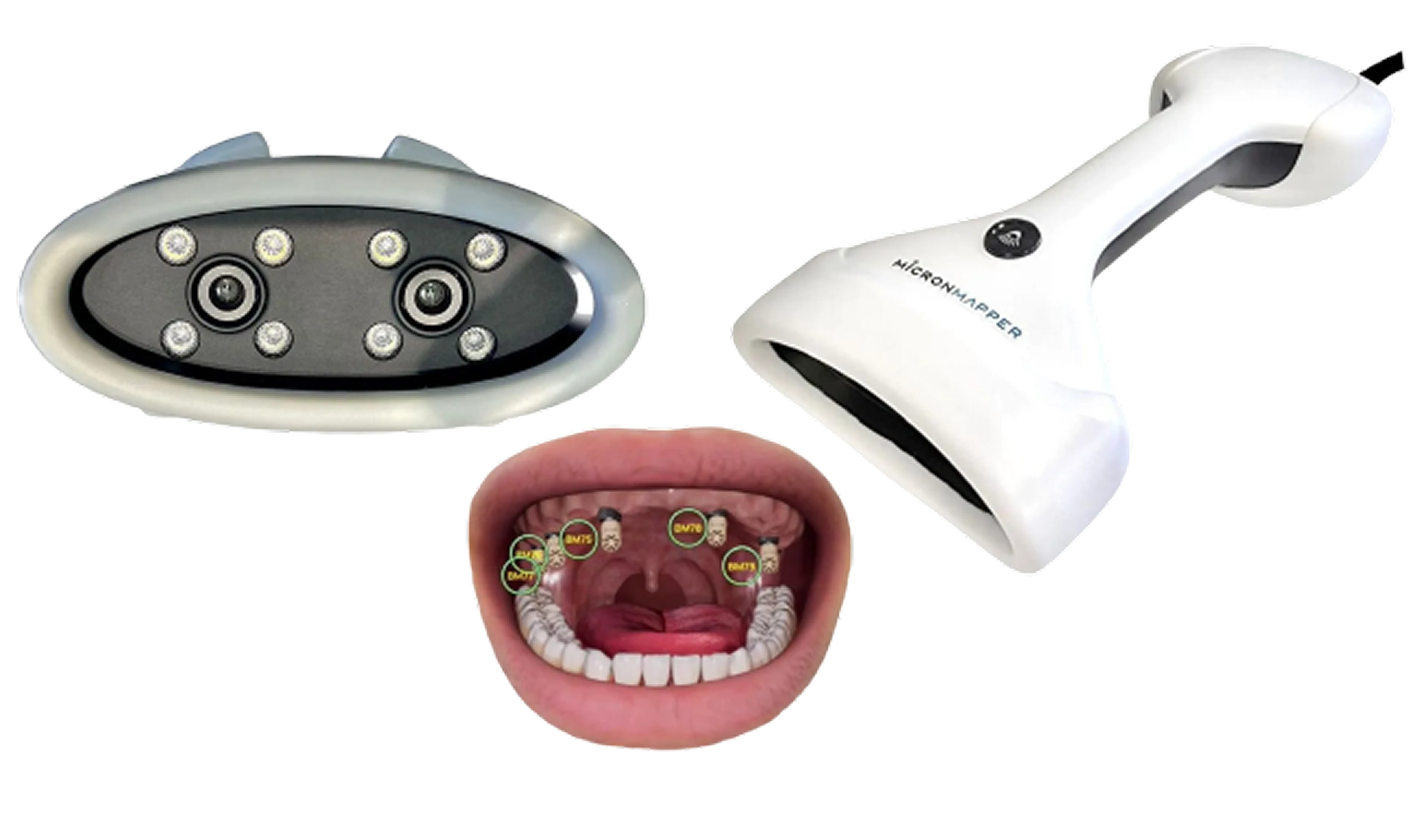 MicronMapper teeth restoration in hours